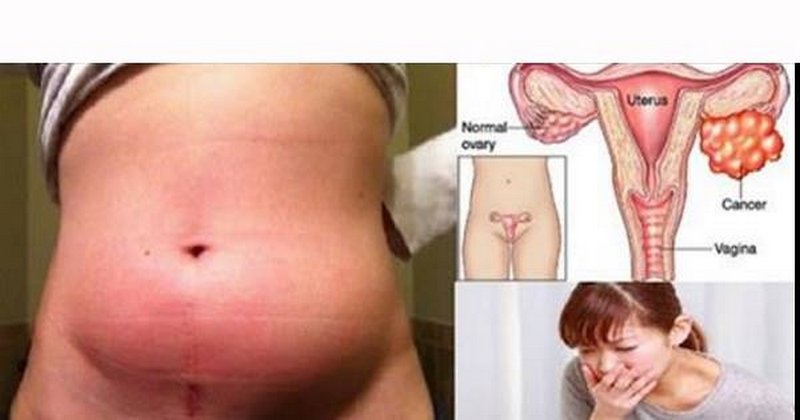 ფრთხილად! 10 ნიშანი, რომელიც არცერთმა ქალმა არ უნდა დააიგნოროს