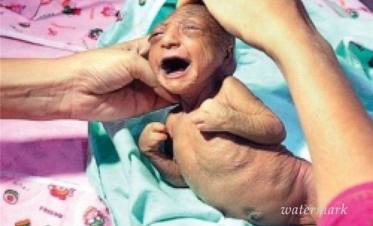 ამ პატარაზე მშობლებმა უარი თქვეს – ექიმები ამ მოვლენას ახსნას ვერ უძებნიან