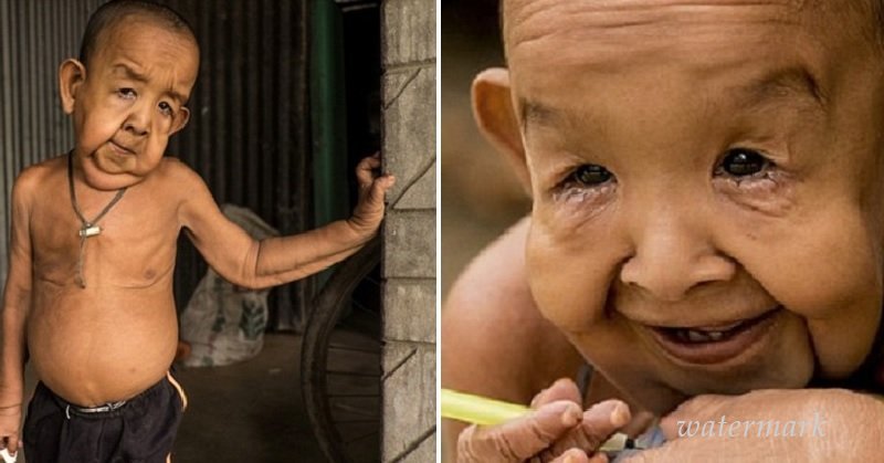 ოთხი წლის ბავში, რომელიც 80 წლის მოხუცს გავს