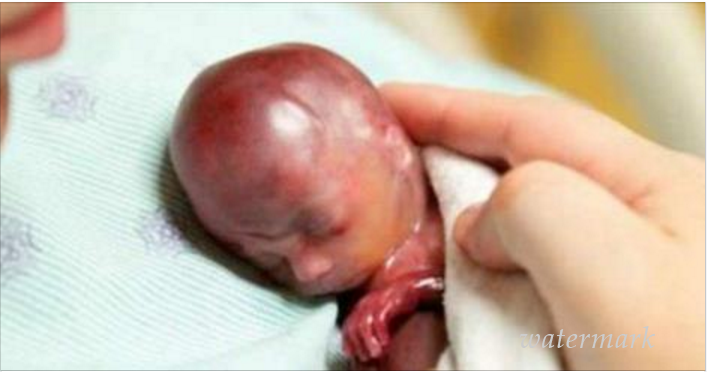 მან მხოლოდ რამდენიმე წუთი იცხოვრა ... ძალიან სევდიანი ისტორია !