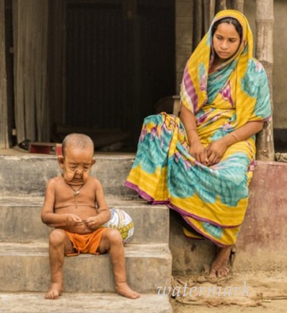 ოთხი წლის ბავში, რომელიც 80 წლის მოხუცს გავს ოთხი წლის ბავში, რომელიც 80 წლის მოხუცს გავს