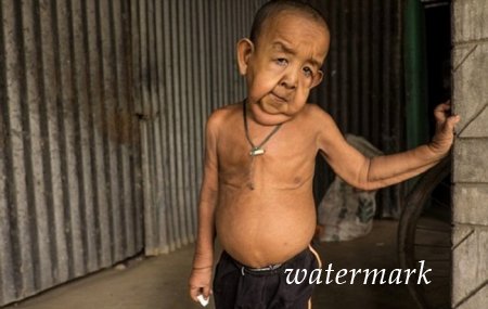 ოთხი წლის ბავში, რომელიც 80 წლის მოხუცს გავს ოთხი წლის ბავში, რომელიც 80 წლის მოხუცს გავს