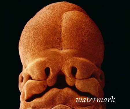 ჩასახვიდან ბავშის დაბადებამდე: 9 თვის განმავლობაში ორგანიზმში მომხდარი ცვლილებები (19 ფოტო) ჩასახვიდან ბავშის დაბადებამდე: 9 თვის განმავლობაში ორგანიზმში მომხდარი ცვლილებები (19 ფოტო)