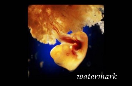 ჩასახვიდან ბავშის დაბადებამდე: 9 თვის განმავლობაში ორგანიზმში მომხდარი ცვლილებები (19 ფოტო) ჩასახვიდან ბავშის დაბადებამდე: 9 თვის განმავლობაში ორგანიზმში მომხდარი ცვლილებები (19 ფოტო)