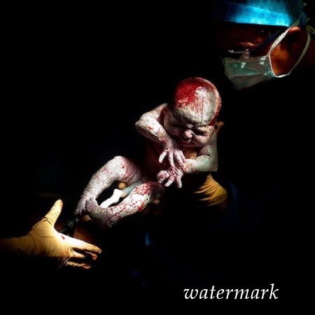 9 დაუჯერებლად ინტიმური კადრი, დაბადებიდან პირველივე წამებზე ... 9 დაუჯერებლად ინტიმური კადრი, დაბადებიდან პირველივე წამებზე ...