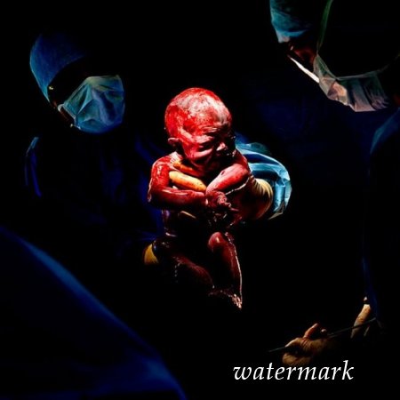 9 დაუჯერებლად ინტიმური კადრი, დაბადებიდან პირველივე წამებზე ... 9 დაუჯერებლად ინტიმური კადრი, დაბადებიდან პირველივე წამებზე ...