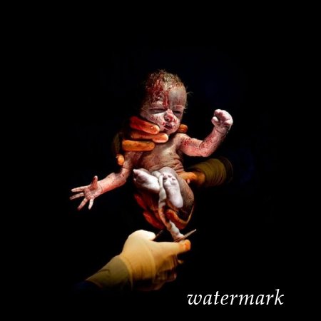 9 დაუჯერებლად ინტიმური კადრი, დაბადებიდან პირველივე წამებზე ... 9 დაუჯერებლად ინტიმური კადრი, დაბადებიდან პირველივე წამებზე ...