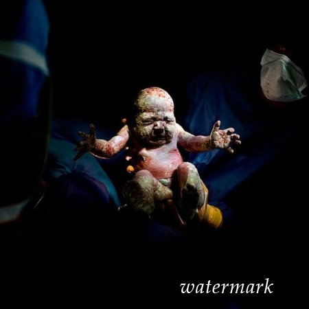 9 დაუჯერებლად ინტიმური კადრი, დაბადებიდან პირველივე წამებზე ... 9 დაუჯერებლად ინტიმური კადრი, დაბადებიდან პირველივე წამებზე ...