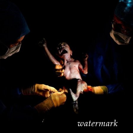 9 დაუჯერებლად ინტიმური კადრი, დაბადებიდან პირველივე წამებზე ... 9 დაუჯერებლად ინტიმური კადრი, დაბადებიდან პირველივე წამებზე ...