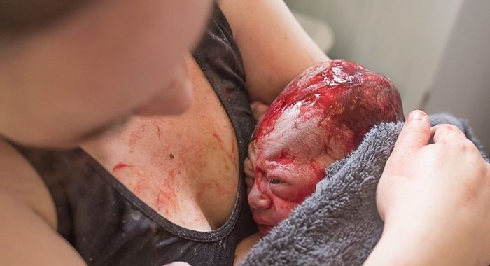 გამაოგნებელი ფოტოები სამშობიაროდან! 14 მომენტი, რომელიც გაოცებულს დაგტოვებთ!