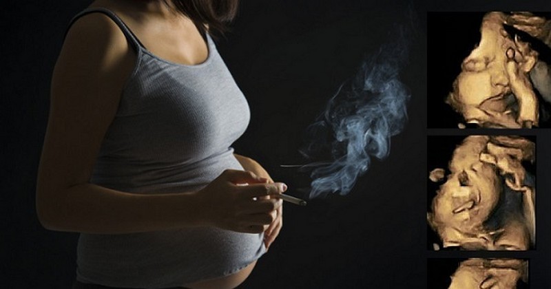 აი, რა მოსდის ნაყოფს, როდესაც დედა ორსულობის დროს ეწევა-შოკისმომგვრელი კადრები!