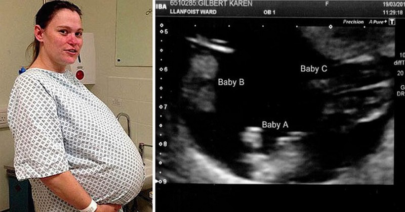 ეს ქალი ბავშვს ელოდებოდა, მაგრამ ექოსკოპიის შედეგების ნახვის შემდეგ მან გონება დაკარგა!